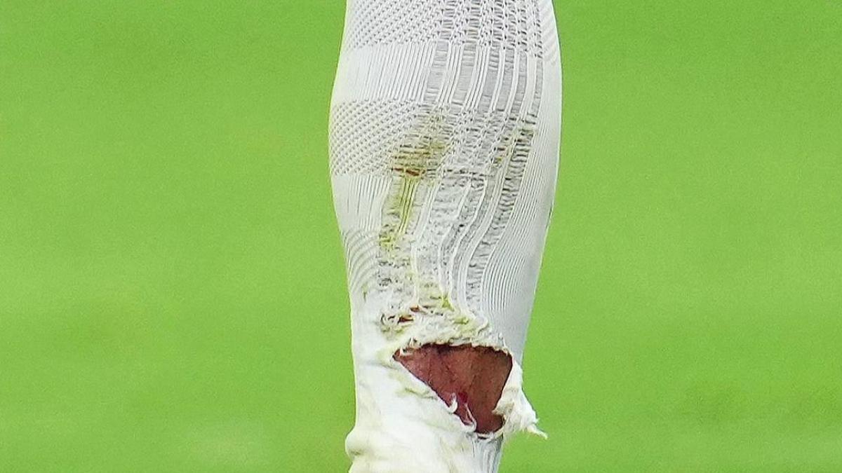 Mbappé blessé mais héroïque : l'état de sa jambe inquiète le Real Madrid